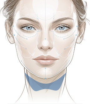 패인주름 (Deep Wrinkles) 이미지